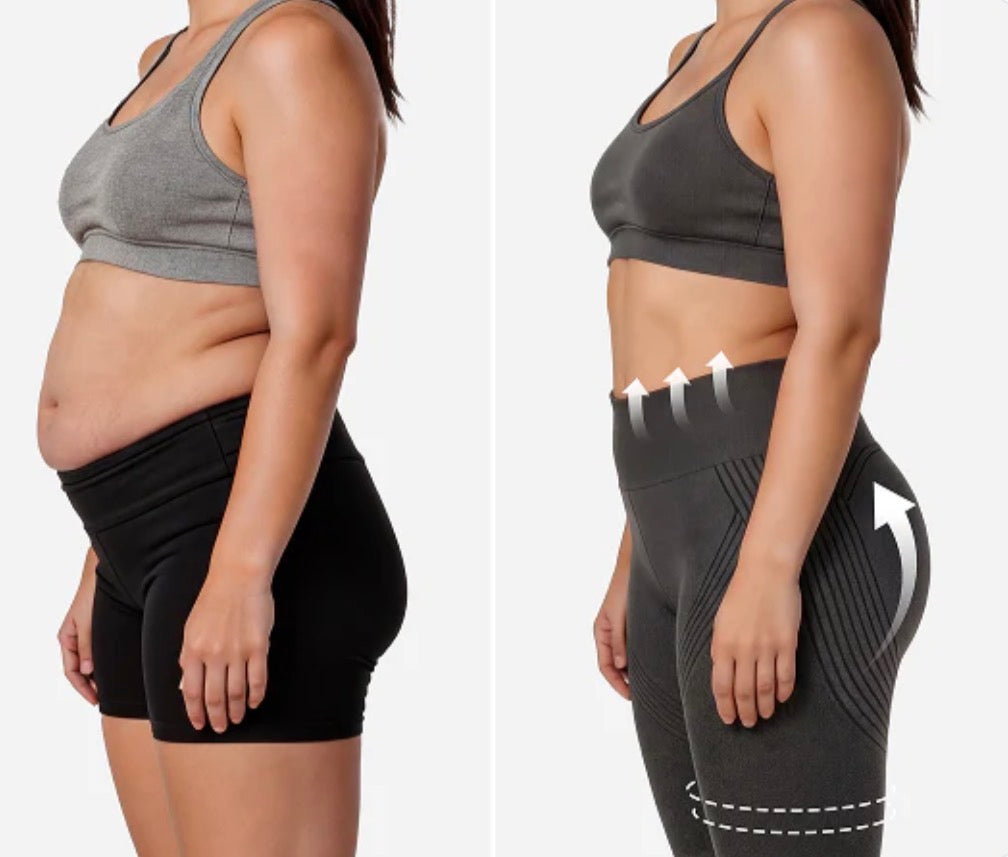 3D Anti-Cellulite Leggings